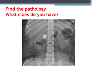 Find the pathology
What clues do you have?
 