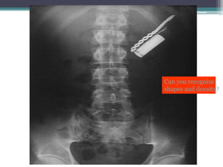 Can you recognize
shapes and density?
 