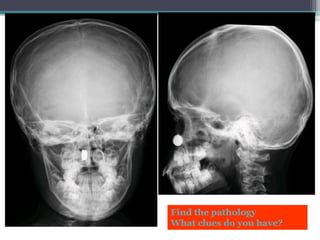 Find the pathology
What clues do you have?
 