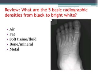 Review: What are the 5 basic radiographic
densities from black to bright white?
• Air
• Fat
• Soft tissue/fluid
• Bone/mineral
• Metal
 