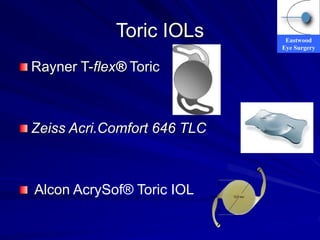 Eastwood
Eye Surgery
Toric IOLs
Rayner T-flex® Toric
Zeiss Acri.Comfort 646 TLC
Alcon AcrySof® Toric IOL
 