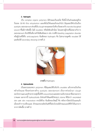 3.	Hydrogels
	 เป็น complex organic polymers มีลักษณะเป็นเจลใส ซึ่งมีน�้ำเป็นส่วนผสมอยู่ด้วย
ร้อยละ 30-90 ช่วย rehydration แผลเพื่อไม่ให้แผลแห้งจนเกินไป มีคุณสมบัติช่วยในเรื่อง
autolyticdebridementส่วนที่เป็นsloughของแผลออกไปด้วยจึงเหมาะกับnecrotic/sloughed
wound ที่ไม่มีการติดเชื้อ ไม่มี exudates หรือมีเพียงเล็กน้อย โดยเฉพาะผู้ป่วยที่ไม่เหมาะกับการ
debridement ด้วยวิธีอื่นที่อาจท�ำให้เสียเลือดมาก เช่น รายที่มี bleeding coagulation disorder
หรือผู้ป่วยที่ได้รับ anticoagulants ข้อเสียของ hydrogels คือ ไม่สามารถดูดซับ exudate ได้
และต้องใช้ secondary dressings (ภาพที่ 2)
ภาพที่ 2 Hydrogels
	 4.	Hydrocolloids
	 เป็นผลรวมของพวก polymers ที่มีคุณสมบัติไปจับกับ exudate แล้วกลายเป็นก้อน
คล้ายก้อนเจล ซึ่งจะช่วยทางด้าน autolytic debridement เป็นการช่วยน�ำเอา slough
ออกไปจากแผล และรักษาความชุ่มชื้นให้กับ wound bed และลดความเจ็บปวดเวลาที่ลอกออกจาก
บาดแผล นอกจากนี้ hydrocolloids ยังช่วยท�ำให้แผลที่เกิดรอบๆ stoma ที่เรียกว่า excoriated
skin และ skin maceration หายได้ด้วย ข้อเสียของวัสดุนี้ คือ หลังจากใส่ลงไปในแผลแล้ว
เมื่อจะท�ำการเปลี่ยนแผล ลักษณะของผลิตภัณฑ์ที่ใส่ลงไปจะมีลักษณะและสีที่ท�ำให้แยกยาก
จากการติดเชื้อ (ภาพที่ 3)
58 แนวทางเวชปฏิบัติการป้องกันและดูแลรักษาผู้ป่วยเบาหวานที่มีภาวะแทรกซ้อนที่เท้า
 