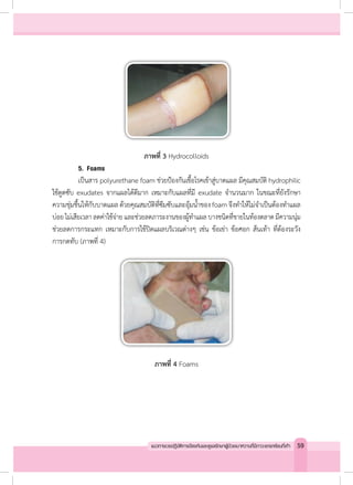 ภาพที่ 3 Hydrocolloids
	 5.	Foams
	 เป็นสาร polyurethane foam ช่วยป้องกันเชื้อโรคเข้าสู่บาดแผล มีคุณสมบัติ hydrophilic
ใช้ดูดซับ exudates จากแผลได้ดีมาก เหมาะกับแผลที่มี exudate จ�ำนวนมาก ในขณะที่ยังรักษา
ความชุ่มชื้นให้กับบาดแผล ด้วยคุณสมบัติที่ซึมซับและอุ้มน�้ำของ foam จึงท�ำให้ไม่จ�ำเป็นต้องท�ำแผล
บ่อยไม่เสียเวลาลดค่าใช้จ่ายและช่วยลดภาระงานของผู้ท�ำแผลบางชนิดที่ขายในท้องตลาดมีความนุ่ม
ช่วยลดการกระแทก เหมาะกับการใช้ปิดแผลบริเวณต่างๆ เช่น ข้อเข่า ข้อศอก ส้นเท้า ที่ต้องระวัง
การกดทับ (ภาพที่ 4)
ภาพที่ 4 Foams
59แนวทางเวชปฏิบัติการป้องกันและดูแลรักษาผู้ป่วยเบาหวานที่มีภาวะแทรกซ้อนที่เท้า
 