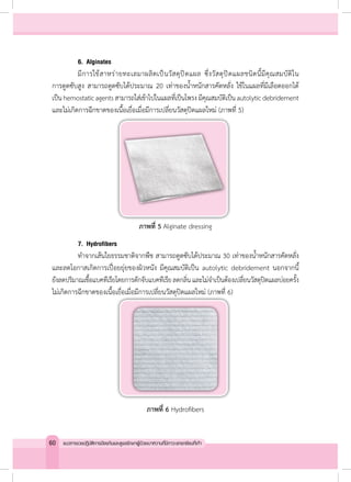6.	Alginates
	 มีการใช้สาหร่ายทะเลมาผลิตเป็นวัสดุปิดแผล ซึ่งวัสดุปิดแผลชนิดนี้มีคุณสมบัติใน
การดูดซับสูง สามารถดูดซับได้ประมาณ 20 เท่าของน�้ำหนักสารคัดหลั่ง ใช้ในแผลที่มีเลือดออกได้
เป็นhemostaticagentsสามารถใส่เข้าไปในแผลที่เป็นโพรงมีคุณสมบัติเป็นautolyticdebridement
และไม่เกิดการฉีกขาดของเนื้อเยื่อเมื่อมีการเปลี่ยนวัสดุปิดแผลใหม่ (ภาพที่ 5)
ภาพที่ 5 Alginate dressing
	 7.	Hydrofibers
	 ท�ำจากเส้นใยธรรมชาติจากพืช สามารถดูดซับได้ประมาณ 30 เท่าของน�้ำหนักสารคัดหลั่ง
และลดโอกาสเกิดการเปื่อยยุ่ยของผิวหนัง มีคุณสมบัติเป็น autolytic debridement นอกจากนี้
ยังลดปริมาณเชื้อแบคทีเรียโดยการดักจับแบคทีเรียลดกลิ่นและไม่จ�ำเป็นต้องเปลี่ยนวัสดุปิดแผลบ่อยครั้ง
ไม่เกิดการฉีกขาดของเนื้อเยื่อเมื่อมีการเปลี่ยนวัสดุปิดแผลใหม่ (ภาพที่ 6)
ภาพที่ 6 Hydrofibers
60 แนวทางเวชปฏิบัติการป้องกันและดูแลรักษาผู้ป่วยเบาหวานที่มีภาวะแทรกซ้อนที่เท้า
 