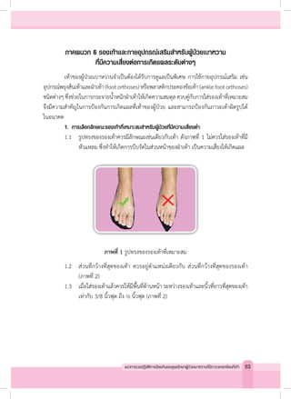 ภาคผนวก 6 รองเท้าและกายอุปกรณ์เสริมส�ำหรับผู้ป่วยเบาหวาน
ที่มีความเสี่ยงต่อการเกิดแผลระดับต่างๆ
	 เท้าของผู้ป่วยเบาหวานจ�ำเป็นต้องได้รับการดูแลเป็นพิเศษ การใช้กายอุปกรณ์เสริม เช่น
อุปกรณ์พยุงส้นเท้าและฝ่าเท้า(footorthoses)หรือพลาสติกประคองข้อเท้า(anklefootorthoses)
ชนิดต่างๆซึ่งช่วยในการกระจายน�้ำหนักฝ่าเท้าให้เกิดความสมดุลควบคู่กับการใส่รองเท้าที่เหมาะสม
จึงมีความส�ำคัญในการป้องกันการเกิดแผลที่เท้าของผู้ป่วย และสามารถป้องกันภาวะเท้าผิดรูปได้
ในอนาคต
	 1.	 การเลือกลักษณะรองเท้าที่เหมาะสมส�ำหรับผู้ป่วยที่มีความเสี่ยงต�่ำ
	 1.1	 รูปทรงของรองเท้าควรมีลักษณะเช่นเดียวกับเท้า ดังภาพที่ 1 ไม่ควรใส่รองเท้าที่มี
	 	 	 หัวแหลม ซึ่งท�ำให้เกิดการบีบรัดในส่วนหน้าของฝ่าเท้า เป็นความเสี่ยงให้เกิดแผล
ภาพที่ 1 รูปทรงของรองเท้าที่เหมาะสม
	 1.2	 ส่วนที่กว้างที่สุดของเท้า ควรอยู่ต�ำแหน่งเดียวกับ ส่วนที่กว้างที่สุดของรองเท้า
	 	 	 (ภาพที่ 2)
	 1.3	 เมื่อใส่รองเท้าแล้วควรให้มีพื้นที่ด้านหน้า ระหว่างรองเท้าและนิ้วที่ยาวที่สุดของเท้า
	 	 	 เท่ากับ 3/8 นิ้วฟุต ถึง ½ นิ้วฟุต (ภาพที่ 2)
63แนวทางเวชปฏิบัติการป้องกันและดูแลรักษาผู้ป่วยเบาหวานที่มีภาวะแทรกซ้อนที่เท้า
 