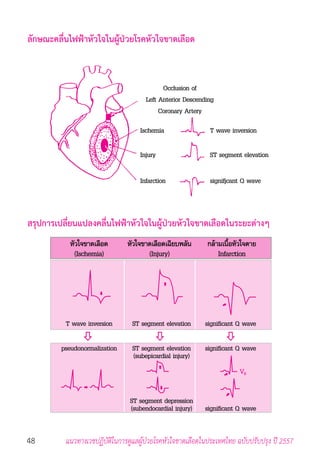 48 แนวทางเวชปฏิบัติในการดูแลผู้ป่วยโรคหัวใจขาดเลือดในประเทศไทย ฉบับปรับปรุง ปี 2557
ลักษณะคลื่นไฟฟ้าหัวใจในผู้ป่วยโรคหัวใจขาดเลือด
สรุปการเปลี่ยนแปลงคลื่นไฟฟ้าหัวใจในผู้ป่วยหัวใจขาดเลือดในระยะต่างๆ
 