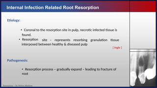 Resorption – Dr. Nithin Mathew
Internal Infection Related Root Resorption
Etiology:
• Coronal to the resorption site in pulp, necrotic infected tissue is
found.
• Resorption site – represents resorbing granulation tissue
interposed between healthy & diseased pulp
Pathogenesis:
• Resorption process – gradually expand – leading to fracture of
root
119
[ Ingle ]
 