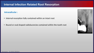 Resorption – Dr. Nithin Mathew
Internal Infection Related Root Resorption
Intraradicular :
• Internal resorption fully contained within an intact root
• Round or oval shaped radiolucencies contained within the tooth root
 
