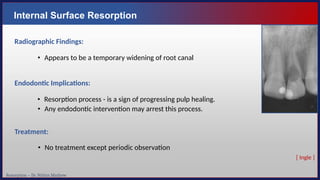 Resorption – Dr. Nithin Mathew
Internal Surface Resorption
Radiographic Findings:
• Appears to be a temporary widening of root canal
Endodontic Implications:
• Resorption process - is a sign of progressing pulp healing.
• Any endodontic intervention may arrest this process.
Treatment:
• No treatment except periodic observation
[ Ingle ]
 