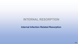 INTERNAL RESORPTION
118
Internal Infection Related Resorption
 