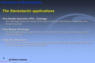 GE Medical Systems
e
Introduction to Mammography
The Stereotactic applications
• Fine Needle Aspiration (FNA - Cytology)
The radiologist places the needle at the point of interest in the breast and aspirates cells
through a syringe
• Core Biopsy (Histology)
The radiologist places a needle at the point of interest in the breast to take tissue samples
using a biopsy gun.
• Hook Wire Placement
Once diagnosis has been made, the radiologist placces a hook wire taht will mark the lesion
and guide the surgeon during the operation.
 