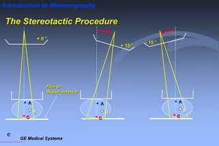 GE Medical Systems
e
Introduction to Mammography
The Stereotactic Procedure
Film or
Digital detector
+ 0 °
A
B
C
+ 15 °
A
B
C
- 15 °
A
B
C
 