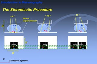 GE Medical Systems
e
Introduction to Mammography
The Stereotactic Procedure
Film or
Digital detector
+ 0 °
A
B
C
X
Y
Z
+ 15 °
A
B
C
- 15 °
A
B
C
 