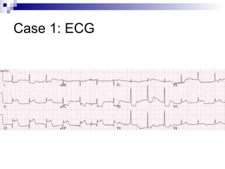 Case 1: ECG 