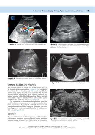 Abdominal Imaging 2nd Edition Dushyant V Sahani Anthony E Samir | PDF