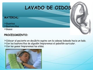 LAVADO DE OIDOS
MATERIAL:
Guantes
Bastoncillos
Gasas
PROCEDIMIENTO:
Colocar al paciente en decúbito supino con la cabeza ladeada hacia un lado.
Con los bastoncillos de algodón limpiaremos el pabellón auricular.
Con las gasas limpiaremos los oídos.
 