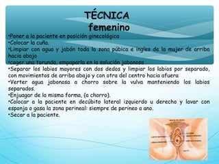 TÉCNICA
femenino
•Poner a la paciente en posición ginecológica
•Colocar la cuña.
•Limpiar con agua y jabón toda la zona púbica e ingles de la mujer de arriba
hacia abajo
•coger una torunda, empaparla en la solución jabonosa .
•Separar los labios mayores con dos dedos y limpiar los labios por separado,
con movimientos de arriba abajo y con otra del centro hacia afuera
•Verter agua jabonosa a chorro sobre la vulva manteniendo los labios
separados.
•Enjuagar de la misma forma, (a chorro).
•Colocar a la paciente en decúbito lateral izquierdo u derecho y lavar con
esponja o gasa la zona perineal: siempre de perineo a ano.
•Secar a la paciente.
 