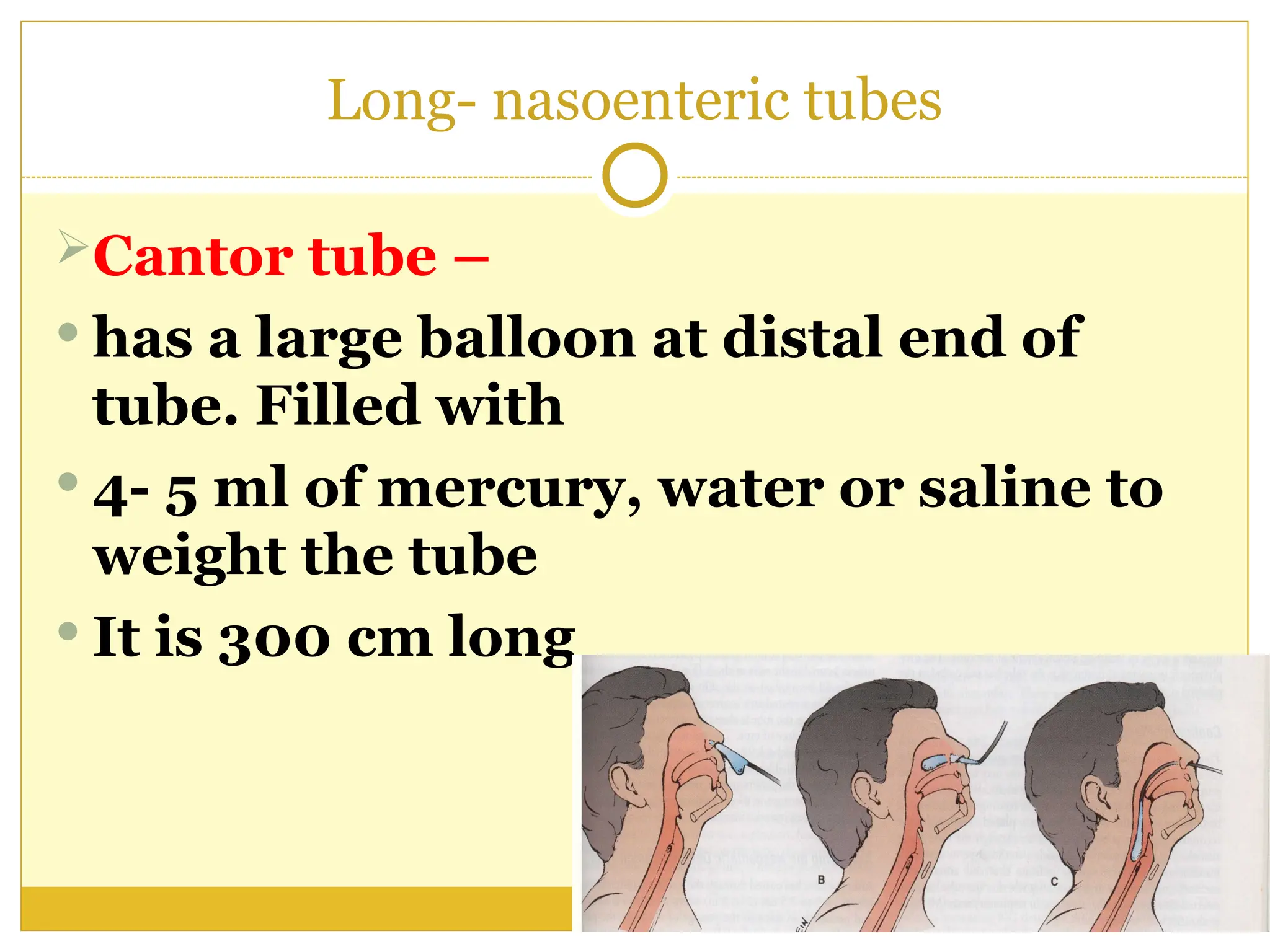 Long- nasoenteric tubes
Cantor tube –
 has a large balloon at distal end of
tube. Filled with
 4- 5 ml of mercury, water or saline to
weight the tube
 It is 300 cm long
 