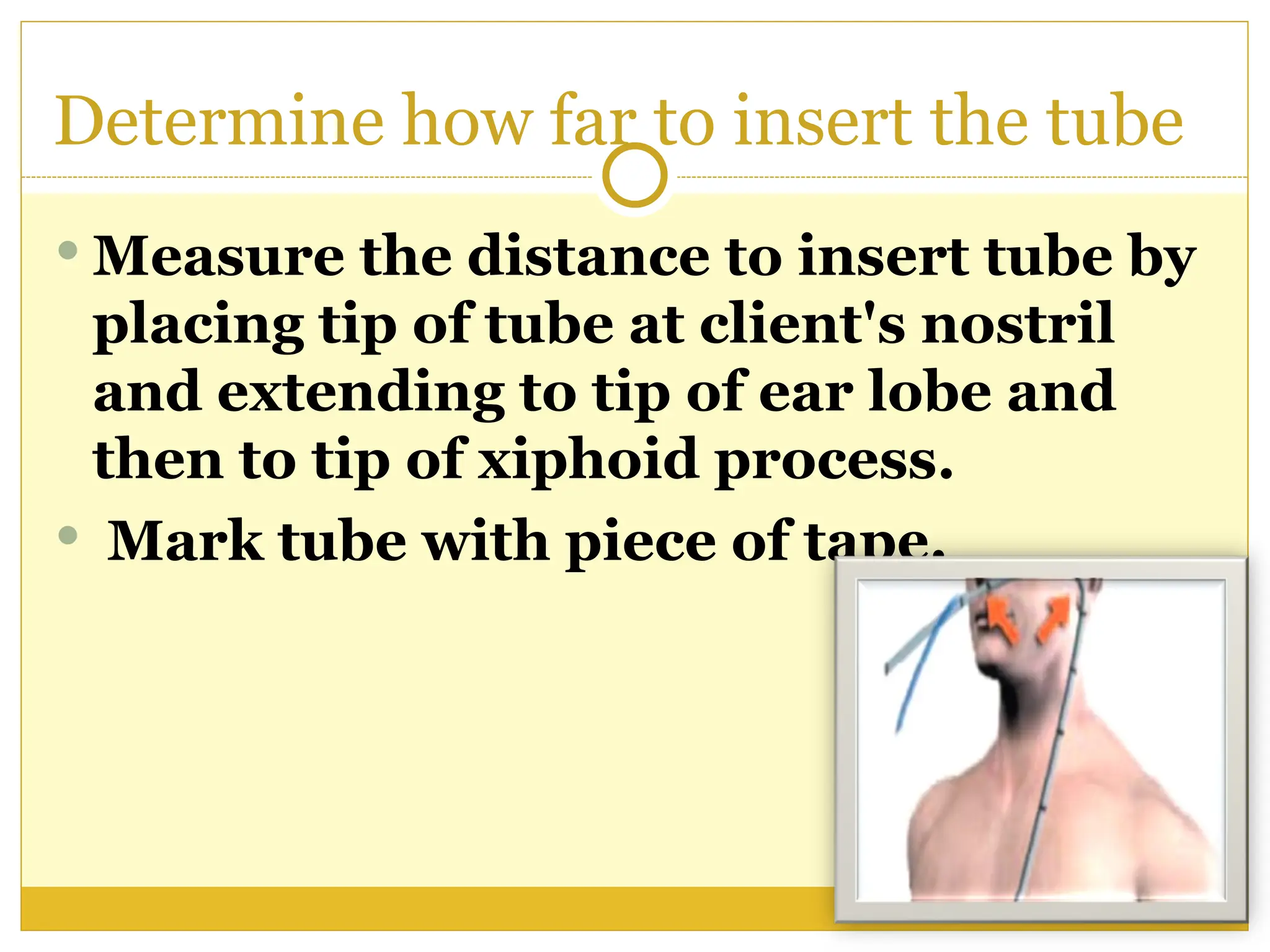 Determine how far to insert the tube
 Measure the distance to insert tube by
placing tip of tube at client's nostril
and extending to tip of ear lobe and
then to tip of xiphoid process.
 Mark tube with piece of tape.
 