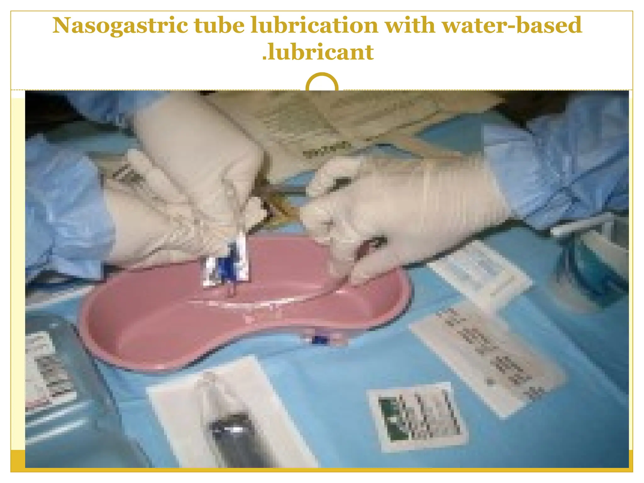 Nasogastric tube lubrication with water-based
lubricant
.
 