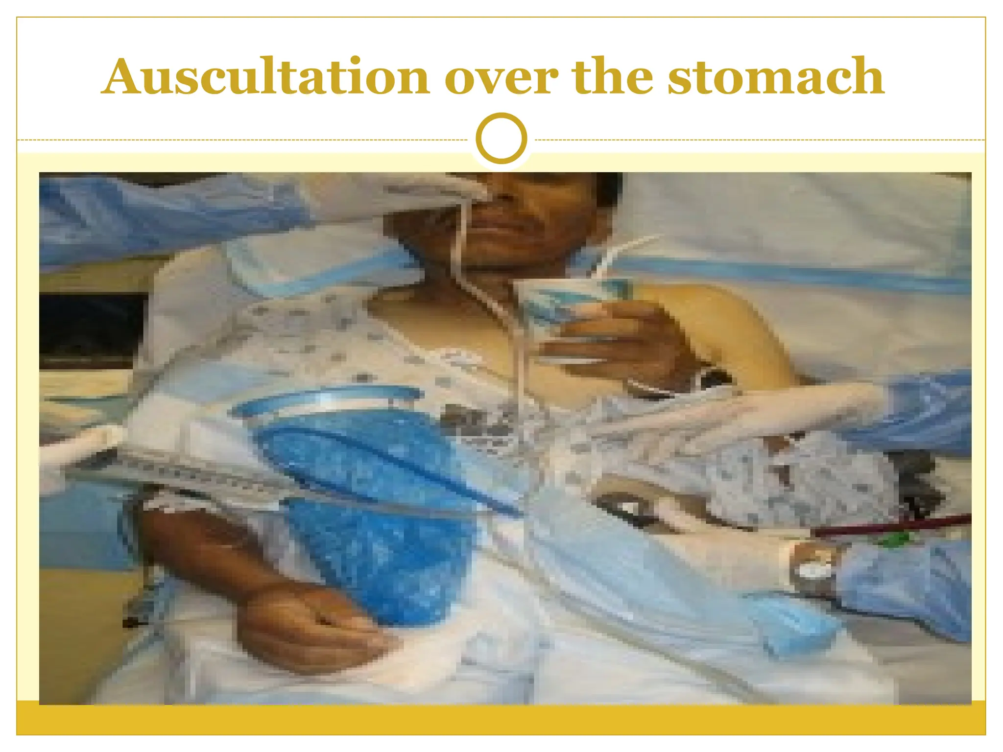 Auscultation over the stomach
 