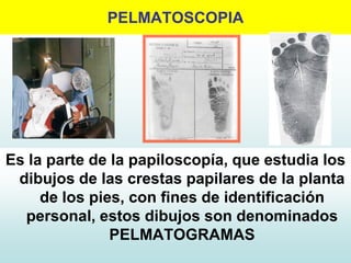 PELMATOSCOPIA
Es la parte de la papiloscopía, que estudia los
dibujos de las crestas papilares de la planta
de los pies, con fines de identificación
personal, estos dibujos son denominados
PELMATOGRAMAS
 