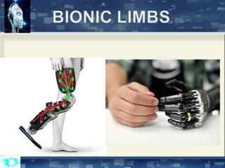 Bionics | PPT