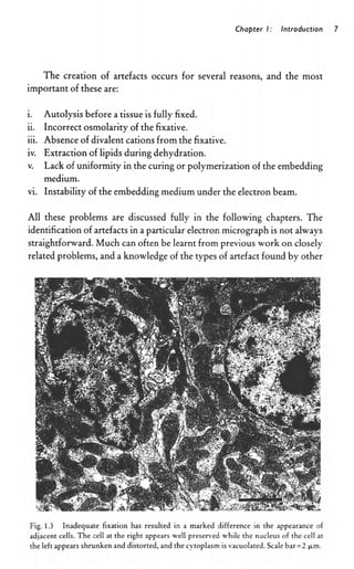 Biological Specimen Preparation For Transmission Electron Microscopy ...