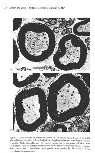 Biological Specimen Preparation For Transmission Electron Microscopy ...