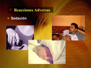 > Sedación
Reacciones Adversas
 