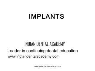 IMPLANTS

INDIAN DENTAL ACADEMY
Leader in continuing dental education
www.indiandentalacademy.com
www.indiandentalacademy.com

 