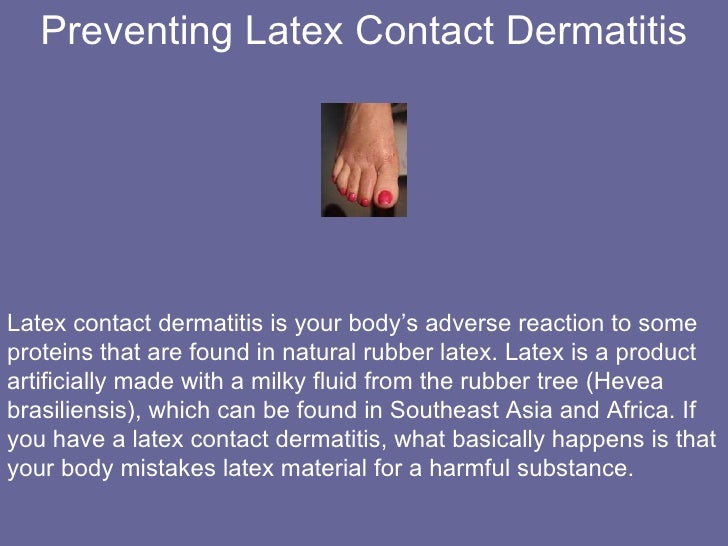 Preventing Latex Contact Dermatitis