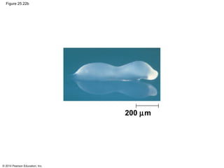 © 2014 Pearson Education, Inc.
Figure 25.22b
200 µm
 