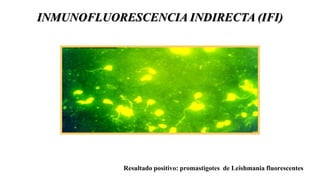 25 LEISHMANIOSIS infectología clase.pptx