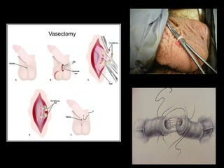 Male Reproductive Anatomy bsc nursing.pptx
