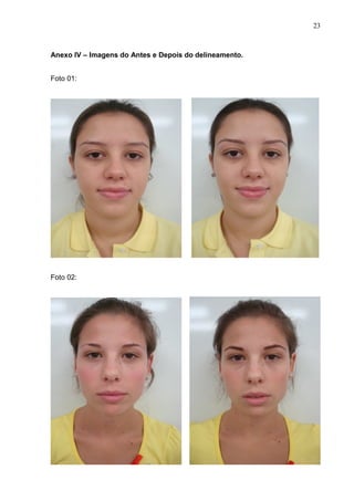 23

Anexo IV – Imagens do Antes e Depois do delineamento.
Foto 01:

Foto 02:

 