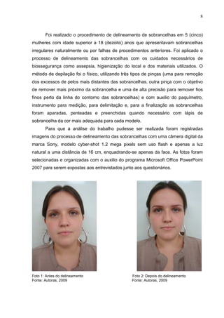 8

Foi realizado o procedimento de delineamento de sobrancelhas em 5 (cinco)
mulheres com idade superior a 18 (dezoito) anos que apresentavam sobrancelhas
irregulares naturalmente ou por falhas de procedimentos anteriores. Foi aplicado o
processo de delineamento das sobrancelhas com os cuidados necessários de
biossegurança como assepsia, higienização do local e dos materiais utilizados. O
método de depilação foi o físico, utilizando três tipos de pinças (uma para remoção
dos excessos de pelos mais distantes das sobrancelhas, outra pinça com o objetivo
de remover mais próximo da sobrancelha e uma de alta precisão para remover fios
finos perto da linha do contorno das sobrancelhas) e com auxilio do paquímetro,
instrumento para medição, para delimitação e, para a finalização as sobrancelhas
foram aparadas, penteadas e preenchidas quando necessário com lápis de
sobrancelha da cor mais adequada para cada modelo.
Para que a análise do trabalho pudesse ser realizada foram registradas
imagens do processo de delineamento das sobrancelhas com uma câmera digital da
marca Sony, modelo cyber-shot 1.2 mega pixels sem uso flash e apenas a luz
natural a uma distância de 16 cm, enquadrando-se apenas da face. As fotos foram
selecionadas e organizadas com o auxilio do programa Microsoft Office PowerPoint
2007 para serem expostas aos entrevistados junto aos questionários.

Foto 1: Antes do delineamento
Fonte: Autoras, 2009

Foto 2: Depois do delineamento
Fonte: Autoras, 2009

 