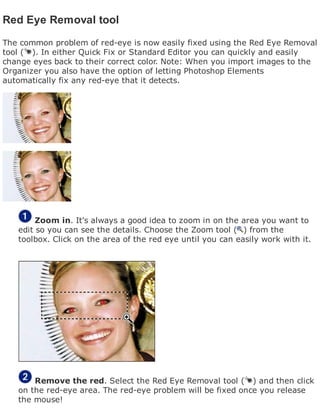 Red Eye Removal tool
The common problem of red-eye is now easily fixed using the Red Eye Removal
tool ( ). In either Quick Fix or Standard Editor you can quickly and easily
change eyes back to their correct color. Note: When you import images to the
Organizer you also have the option of letting Photoshop Elements
automatically fix any red-eye that it detects.
Zoom in. It's always a good idea to zoom in on the area you want to
edit so you can see the details. Choose the Zoom tool ( ) from the
toolbox. Click on the area of the red eye until you can easily work with it.
Remove the red. Select the Red Eye Removal tool ( ) and then click
on the red-eye area. The red-eye problem will be fixed once you release
the mouse!
 