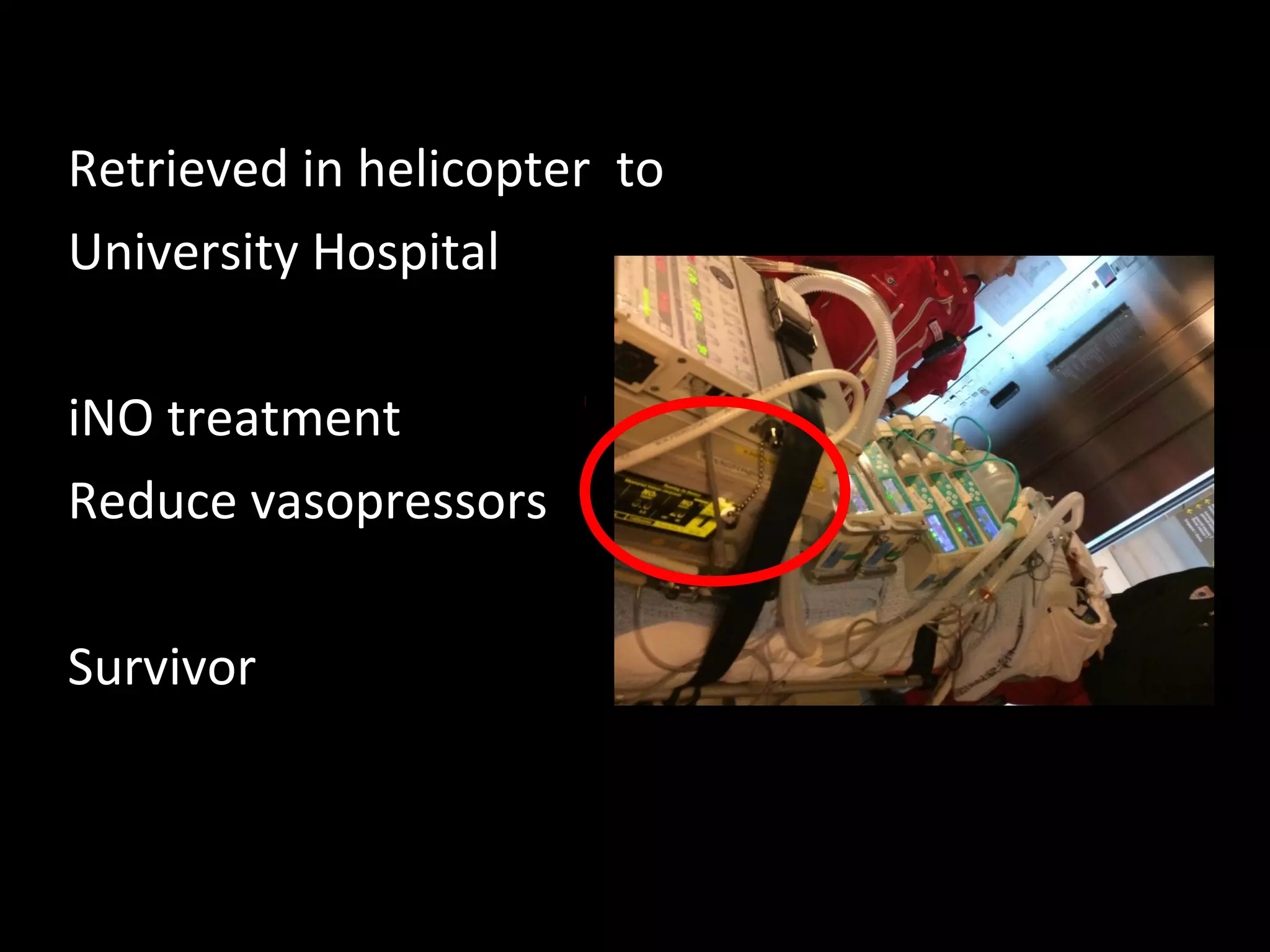 Retrieved in helicopter to
University Hospital
iNO treatment
Reduce vasopressors
Survivor
 