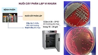 25_Y_TT B2 Cấy phân lập, định danh vi sinh y hịc | PDF
