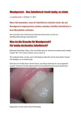 Mundgeruch – Das Zahnfleisch riecht faulig, es stinkt.
by sachakarmoll | on October 11, 2013
Wenn Sie feststellen, dass Ihr Zahnfleisch schlecht riecht, Sie auf
Mundgeruch angesprochen werden und/oder schlaffes Zahnfleisch in
Ihrer Mundhöhle vorfinden,
dann ist es Zeit, einen Zahnarzt Ihres Vertrauens aufzusuchen, der sich auf
Zahnfleischbehandlungen spezialisiert hat.
Was ist die Ursache für Mundgeruch?
Für faulig riechendes Zahnfleisch?
Bakterieller Zahnbelag, Plaque, oder auch Biofilm genannt, wobei die ansonsten positiv belegte
Vorsilbe “Bio-” hier in einem anderen Licht zu sehen ist.
“Bio” bedeutet Leben, und das, was im Zahnbelag so alles lebt, ist Ihrer Gesundheit in diesem
Fall abträglich, ja, es schadet sogar.
Damit Sie sich ein Bild davon machen können, was Plaque überhaupt ist, wie sie eigentlich
aussieht, betrachten Sie bitte folgendes Bild einer Zahnfleischentzündung am Backenzahn:
Backenzahn mit einer dicken Schicht Zahnbelag
 