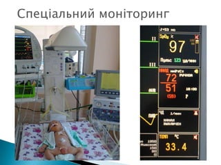 Спеціальний моніторинг
 