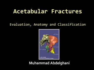 Acetabular FracturesAcetabular Fractures
Evaluation, Anatomy and ClassificationEvaluation, Anatomy and Classification
Muhammad Abdelghani
 
