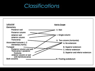 26. acetabular fractures anatomy, evaluation and classification ...
