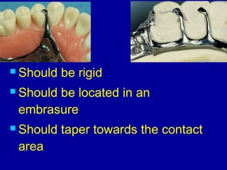 26. designing of rpd | PPT