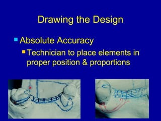 26. designing of rpd | PPT