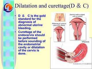 Dilatation and curettage(D ＆ C) D  ＆  C is the gold standard for the diagnosis of abnormal uterine bleeding.  Curettage of the endocervix should be performed before sounding of the endometrial cavity or dilatation of the cervix is done. 