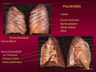 PULMONES Vértice   Cisura transversa Borde posterior Borde anterior Base  Cicura transversa Cisura oblicua HILIO PULMONAR art. Pulmonar bronquio fuente venas pulmonares 