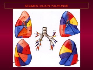 SEGMENTACION PULMONAR 