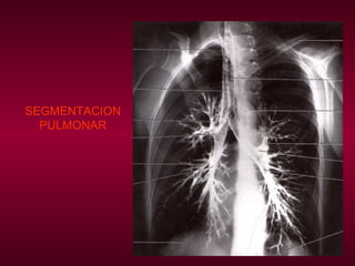 SEGMENTACION PULMONAR 